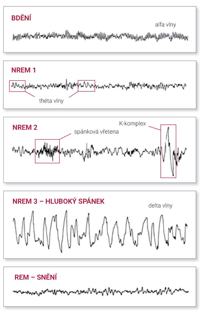 EEG – záznam mozkových vln v jednotlivých fázích spánku